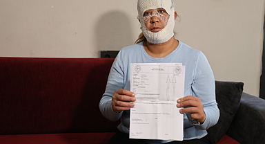 Güzelleşmek uğruna gittiği merkezde yüzü yandı