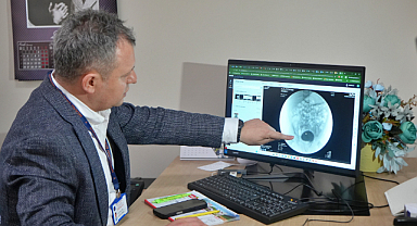 Her 100 erkek bebeğin 3'ünde görülüyor